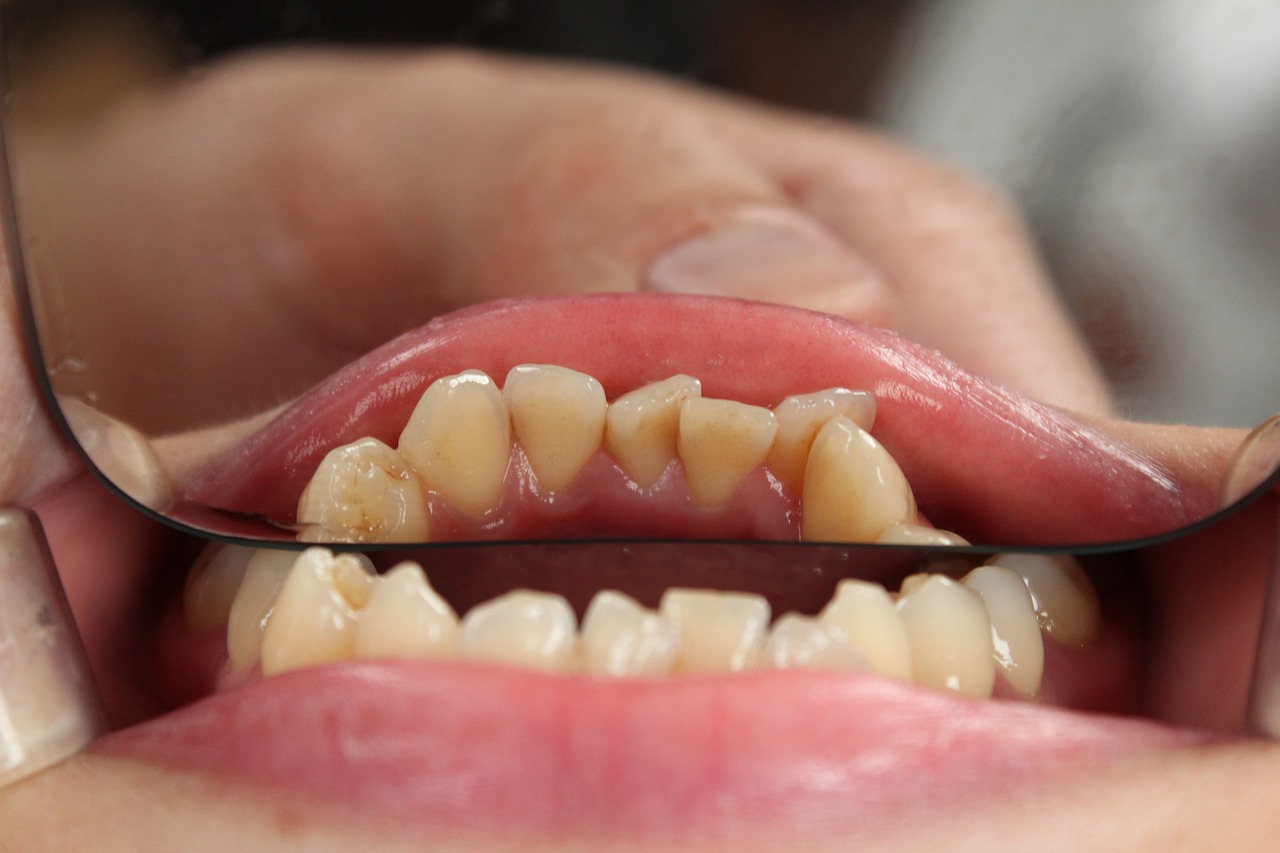 Jak zadbać o dobry stan naszych zębów?